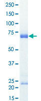 Loading 1 &mu;g protein in SDS-PAGE